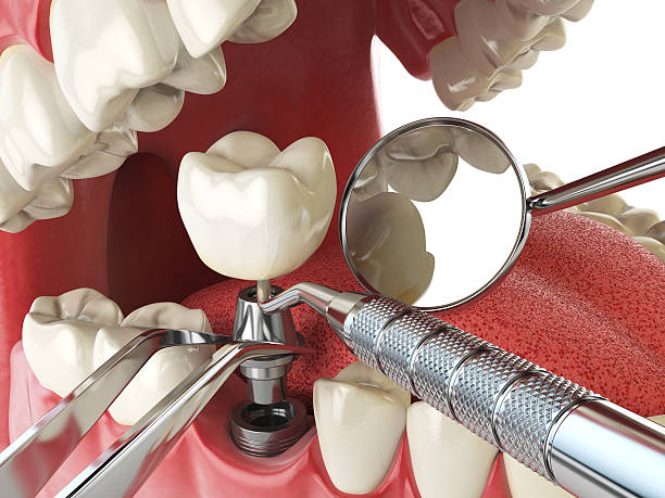 Best Emergency Dental Services for Seniors in Highland Springs, VA